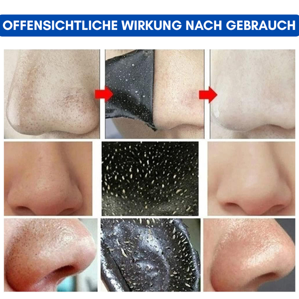Aktivkohle Klare Nasenstreifen