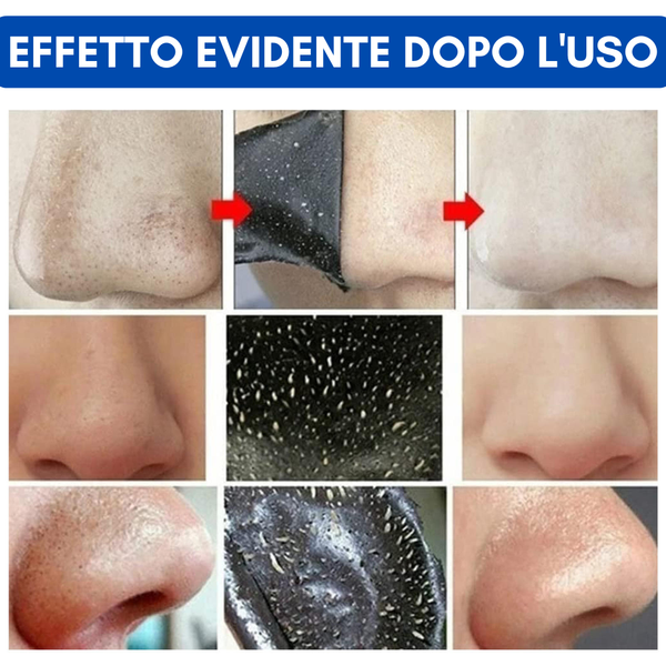 Strisce per il naso trasparenti al carbone