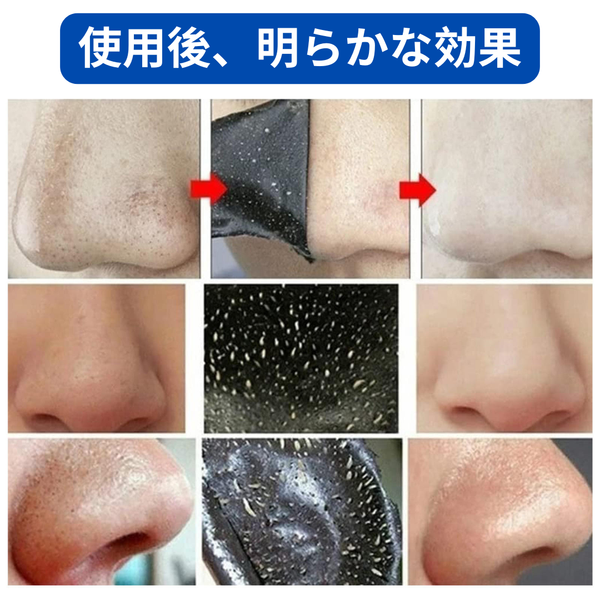 チャコールクリアノーズストリップ