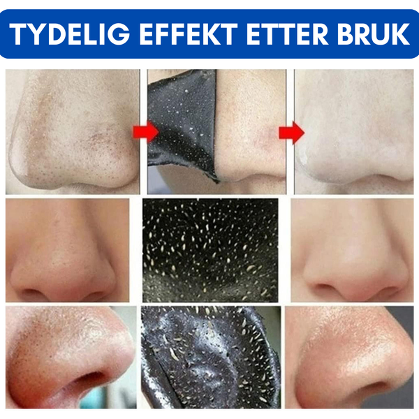 Kull Klare Nesestrimler