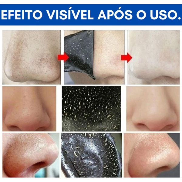 Tiras Nasais Transparentes de Carvão